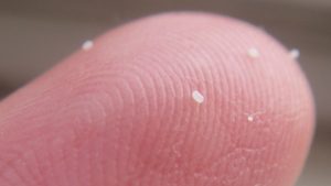 Huevos de pulga en el dedo humano