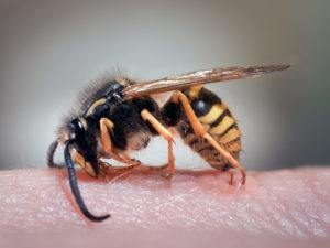 Lávate la mano de un humano con el picor en la piel.