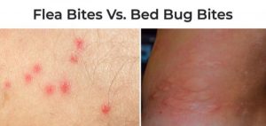 Diferencia entre las picaduras de pulgas y las picaduras de insectos de la cama en la piel humana