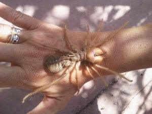 Mordeduras de araña de camello en manos humanas