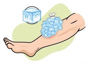 Compresa de hielo en la pierna