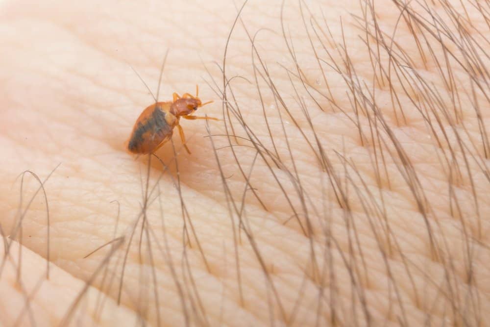 Insecto de la cama que se esconde en el cabello humano