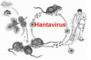 Los síntomas del Hantavirus en humanos